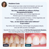 Pó para branqueamento dentário aprovado por dentistas