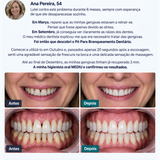 Pó para branqueamento dentário aprovado por dentistas
